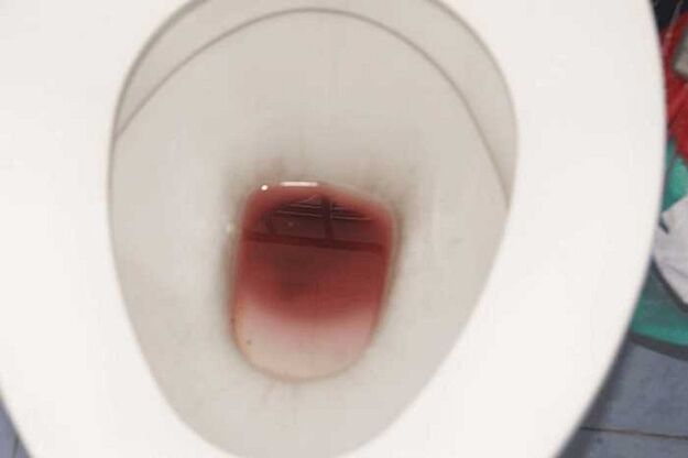 興奮したときに男性に注目する